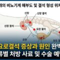 강아지 요로결석 증상 원인 결석 종류별 처방 수술 예방